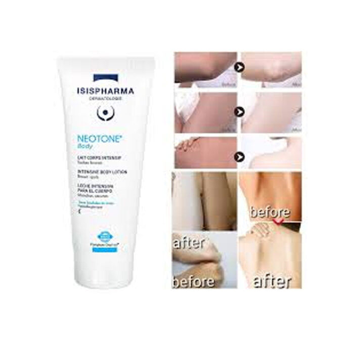 ISIS PHARMA NEOTONE BODY MILK - 100 ML - Image 2