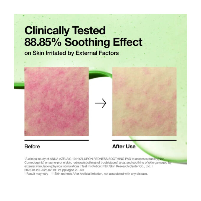 Anua Soothing Pad Azlaic10 + Hyaluron - 90pads - Image 3